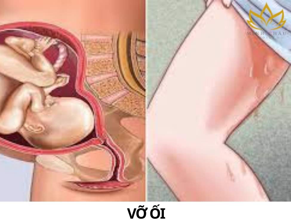 Những dấu hiệu nguy hiểm khi mang thai tháng cuối