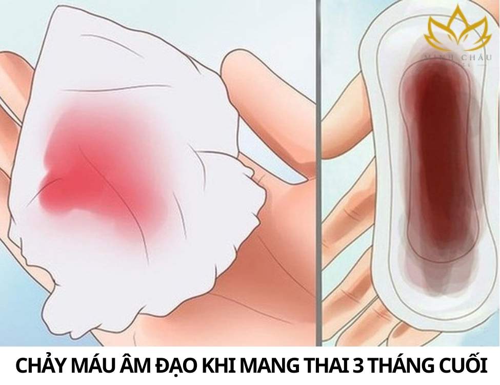 Những dấu hiệu nguy hiểm khi mang thai tháng cuối