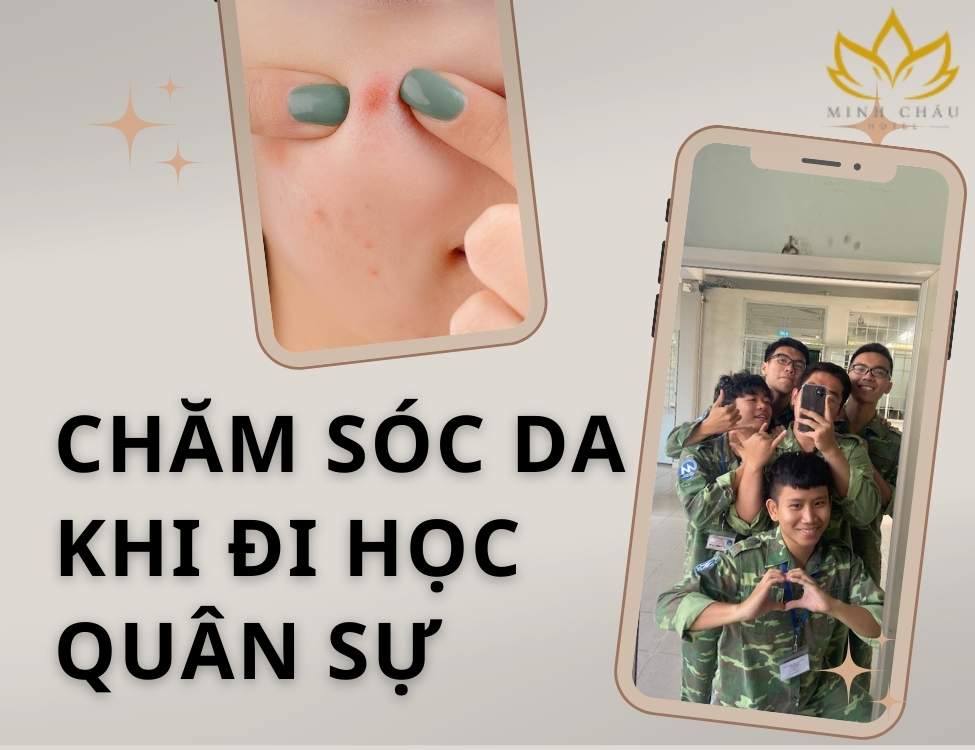 Chăm sóc da khi đi học quân sự